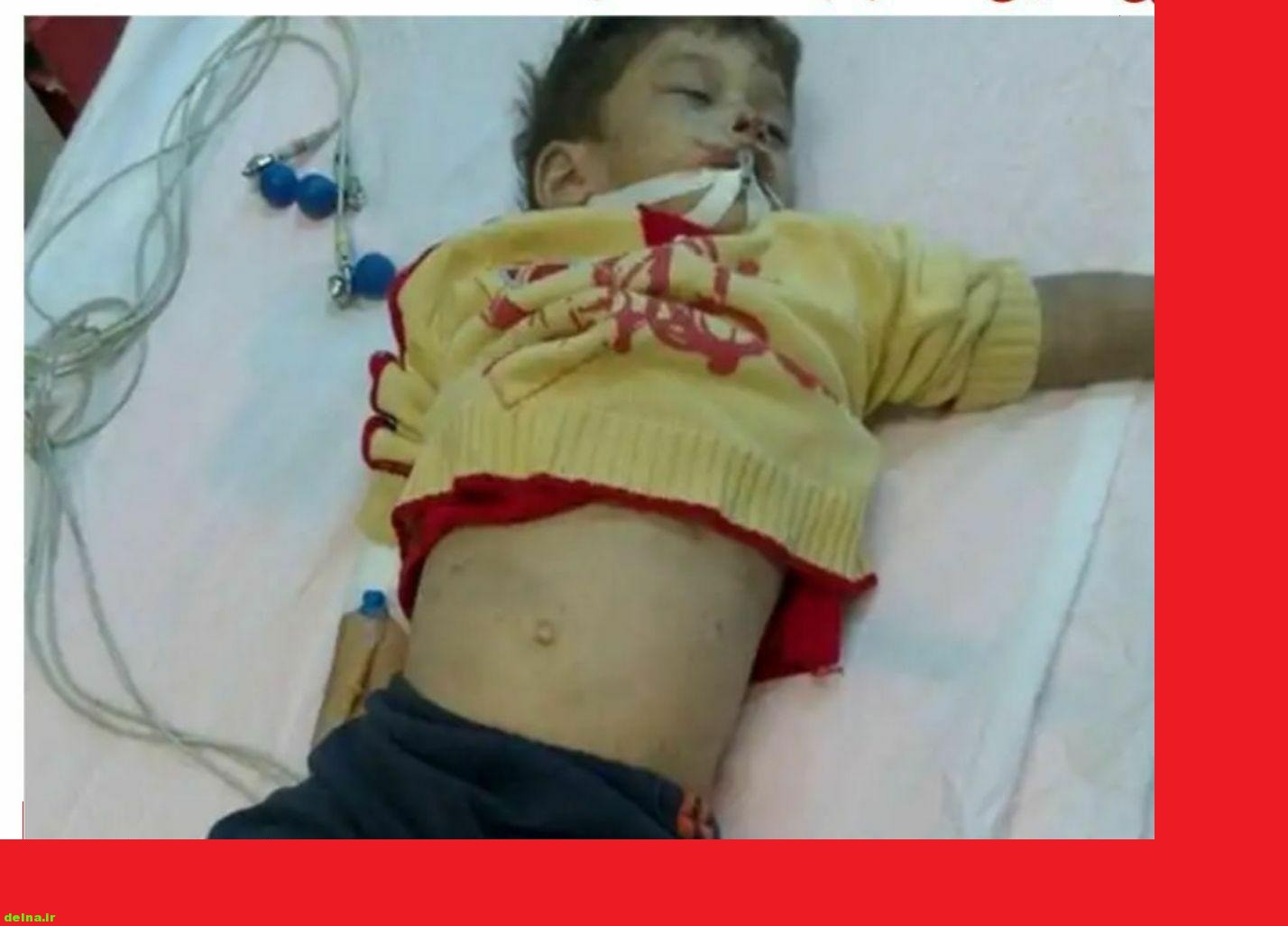 مرگ کودک 4 سال بر اثر کتک زدن توسط خاله